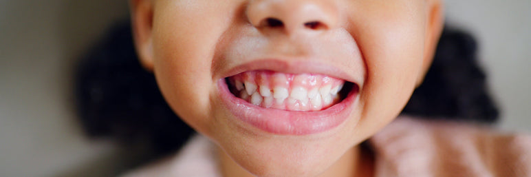 Are Gummy Vitamins Safe for Kids’ Teeth?